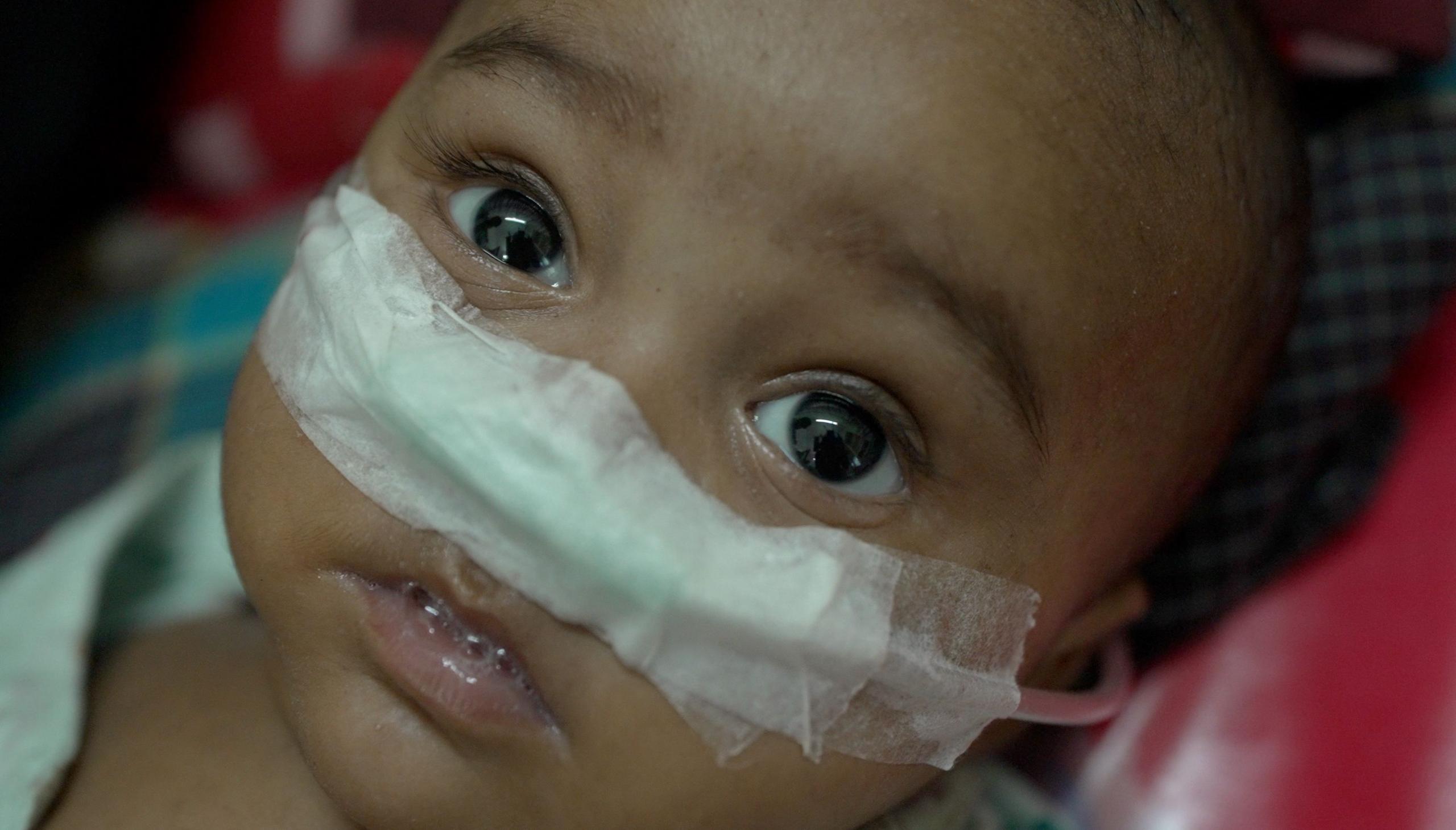 Measles outbreak shatters Bangladesh’s decade of progress on child health