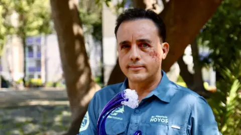 Biologist Attacked by Shark Reflects on Survival and Hope for Reunion