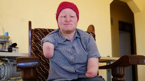 The Ongoing Fear for People with Albinism in Tanzania During Election Seasons