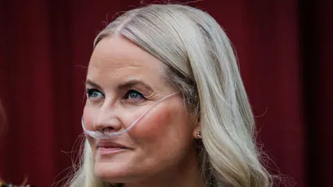 Norway's Crown Princess' Lung Transplant Highlights Climate‑Linked Respiratory Health Crisis